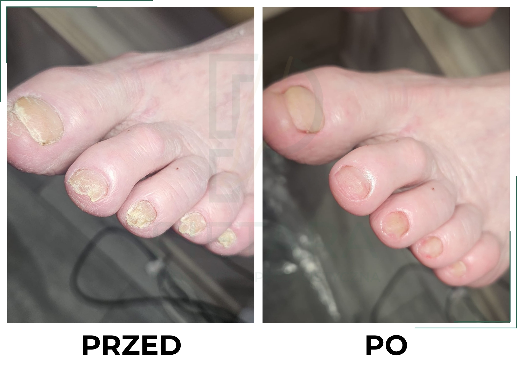 PRZED (2)