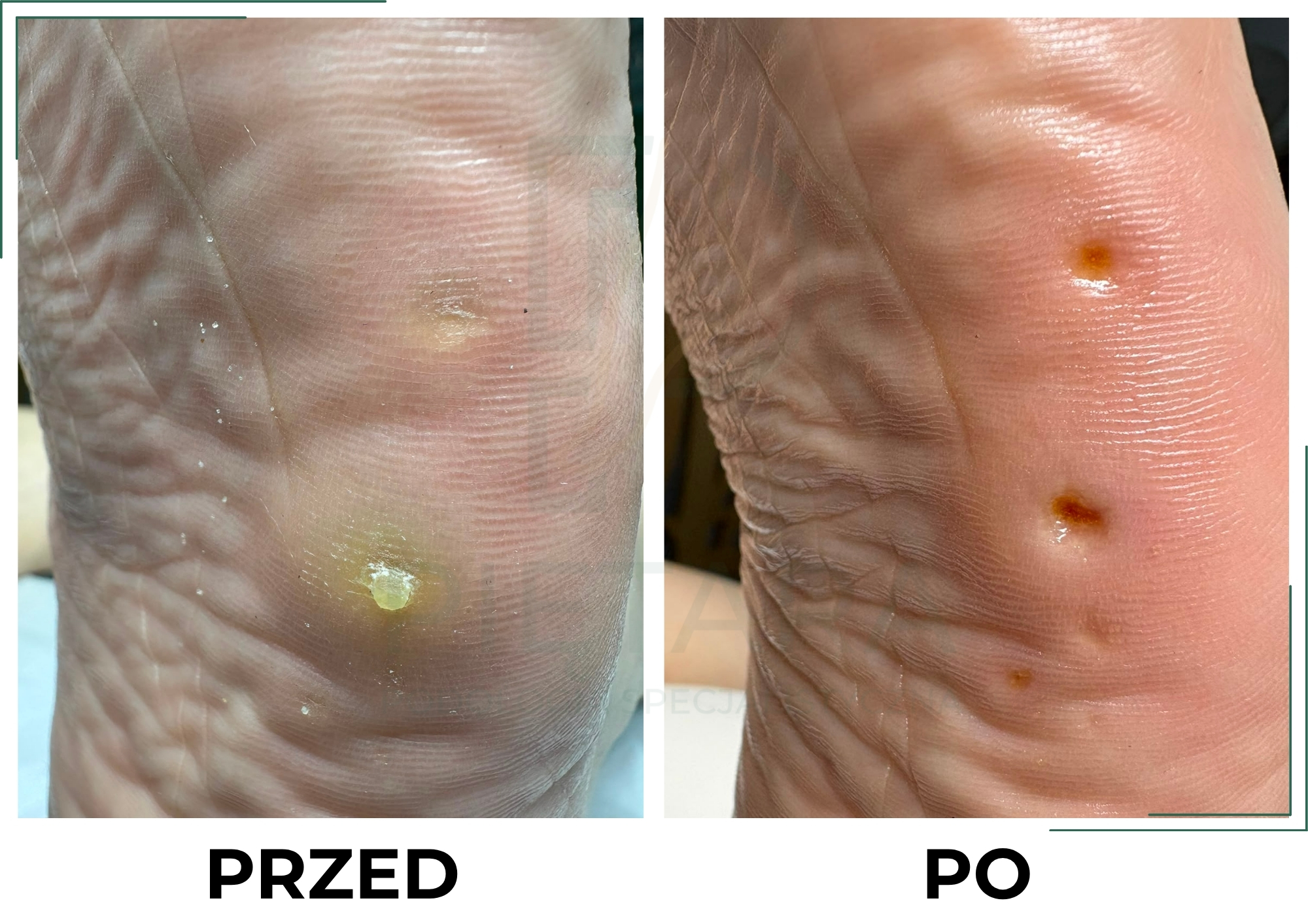 PRZED (3)