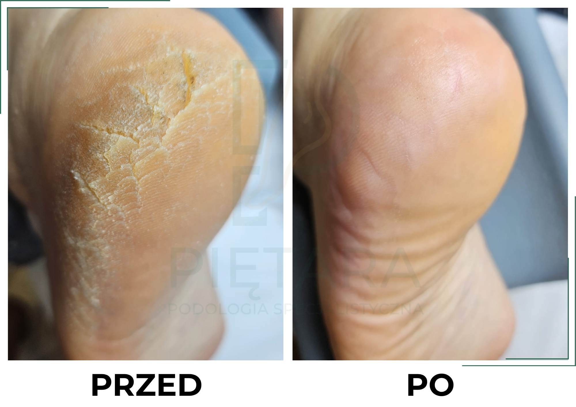 PRZED (4)