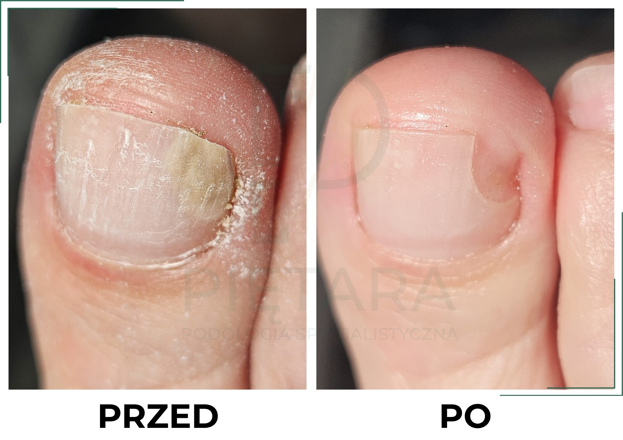 PRZED (5)