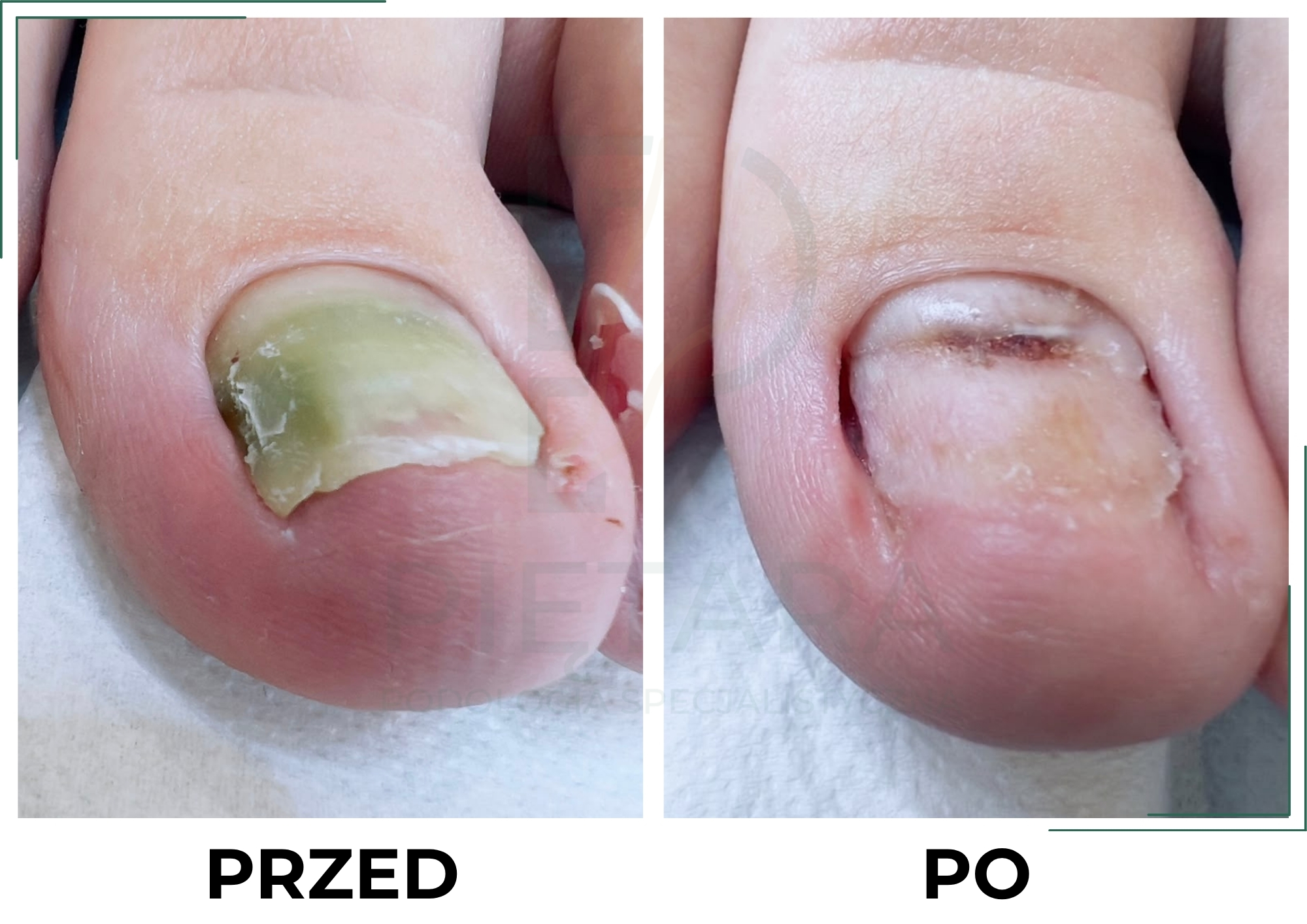 PRZED (6)
